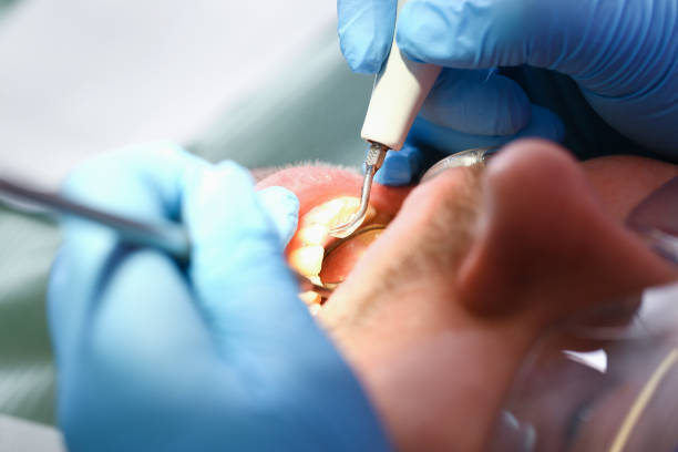 Best Pediatric Emergency Dentist in Northern Cambria, PA